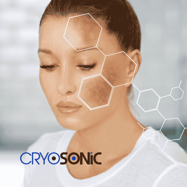 Are you looking for age spot removal treatment? Contact Cryosonic today in Christchurch