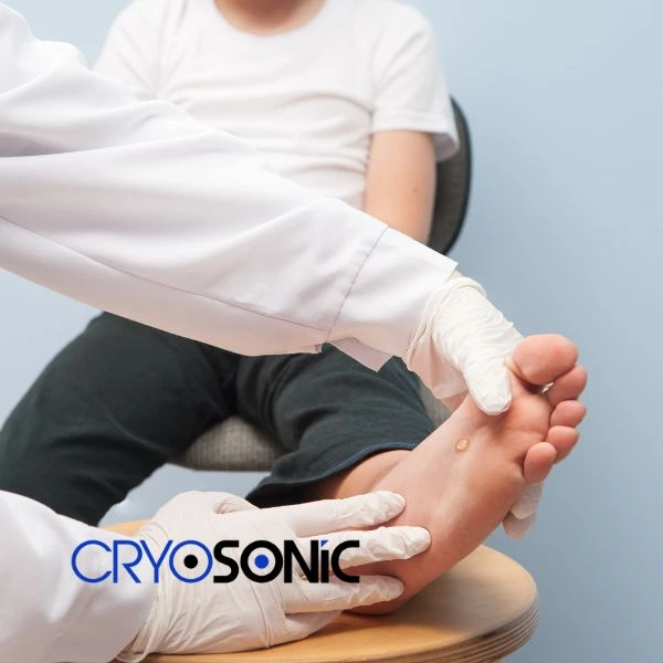 Are you looking for fast effective wart removal Contact us today Christchurch